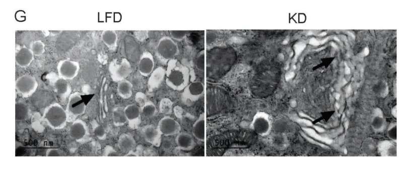 Popular keto diet linked to glucose intolerance and fatty liver in mice